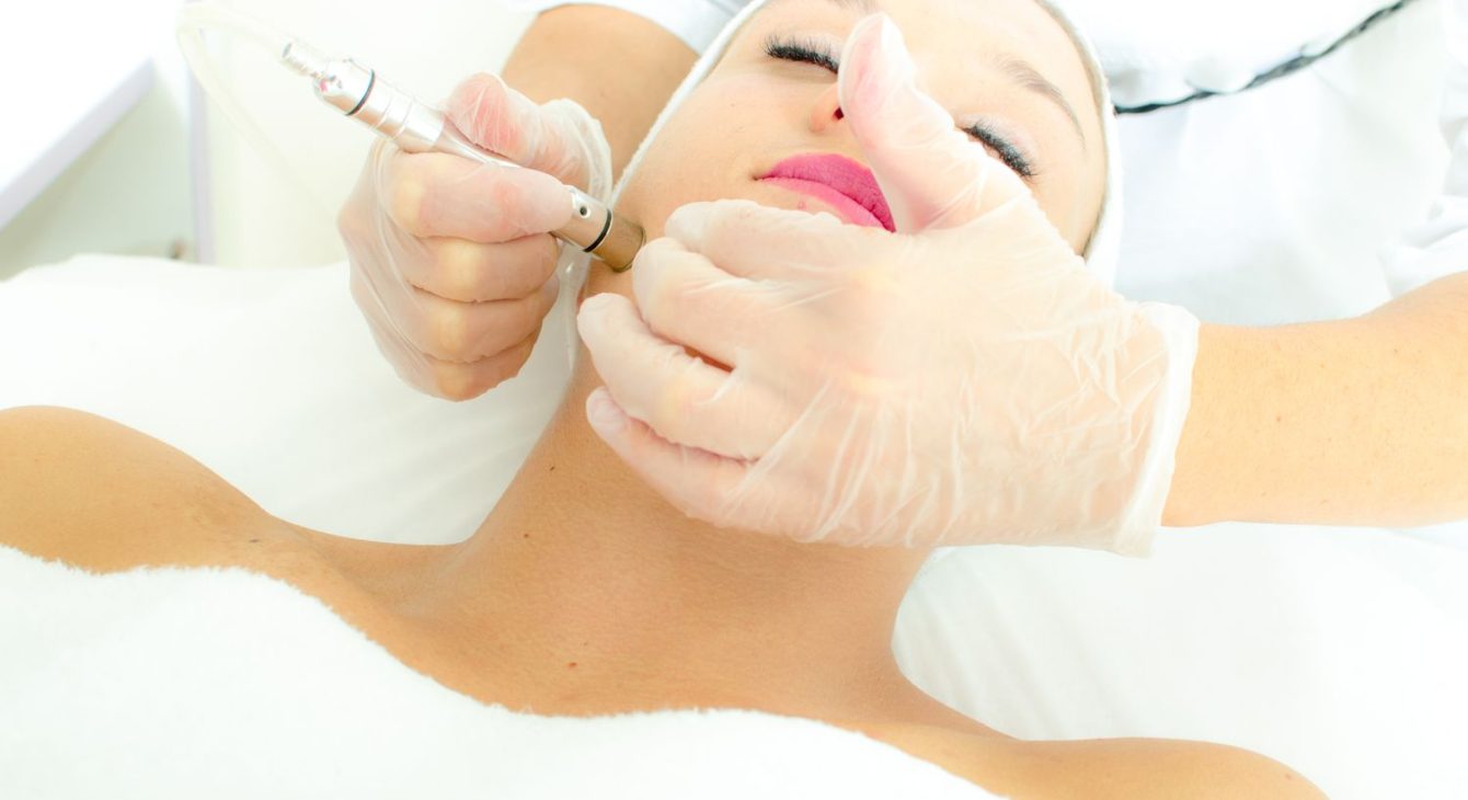 Microdermabrasion Facial