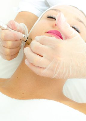 Microdermabrasion Facial