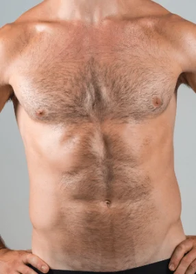 Men 4 Zones (Back Underarms Stomach Chest )